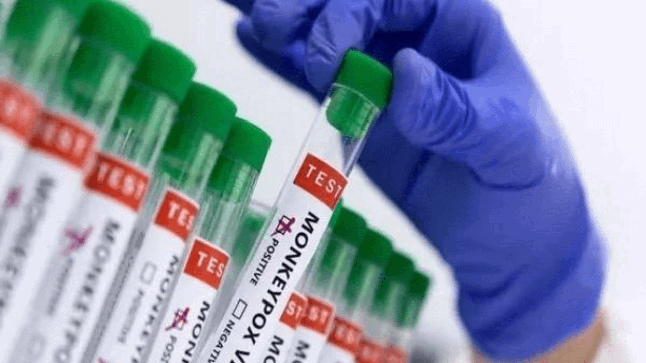 Karnataka reports first Mpox case this year as Dubai returnee tests positive