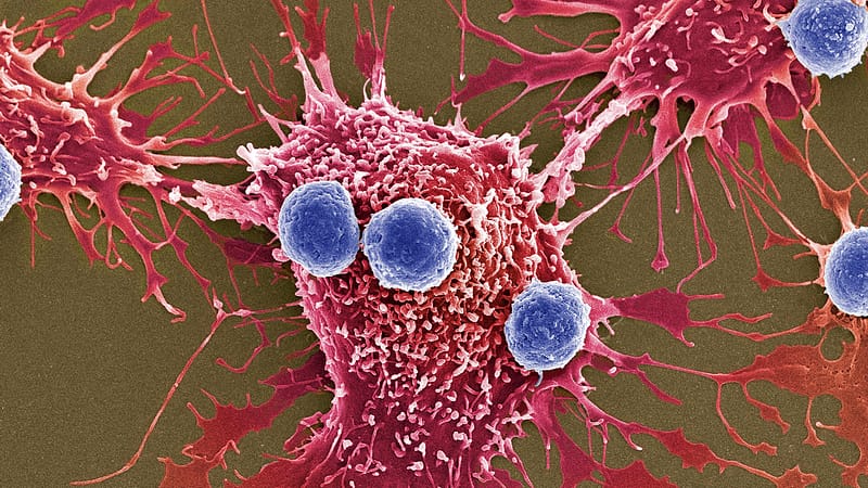 Step-by-Step Guide To Finding the Best Hospital for Cancer Treatment